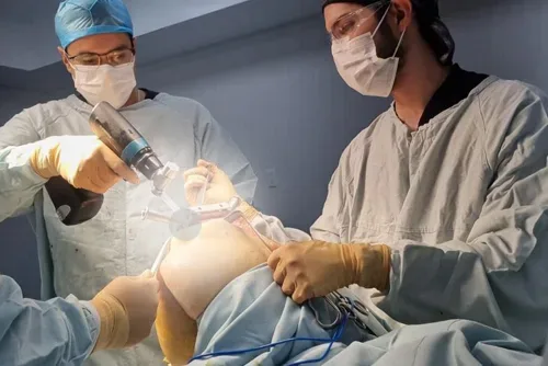 Prótesis de rodilla